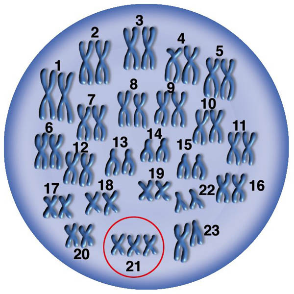 chromosomy_trisomie_539037.jpg (62337 bytes)